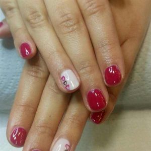 shellac removal galway